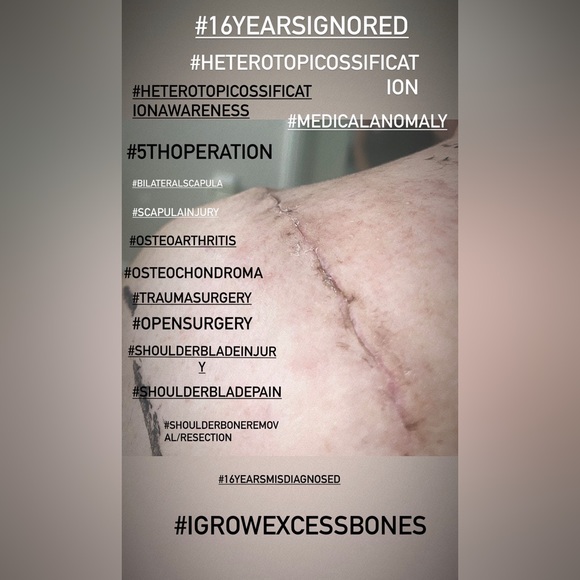 Waiting on next specialist🧿Malpractice Complications🧿 - Picture 5 of 11